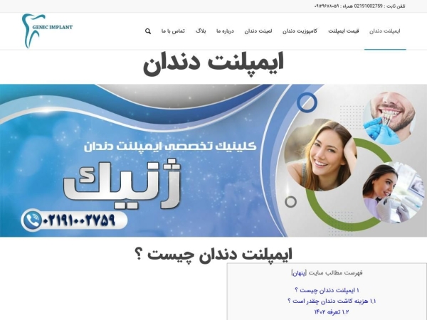 genicimplant.com
